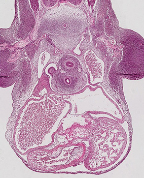 A histology section of a human embryo