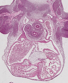 A histology section of a human embryo