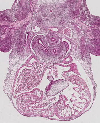 A histology section of a human embryo