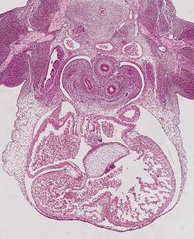A histology section of a human embryo