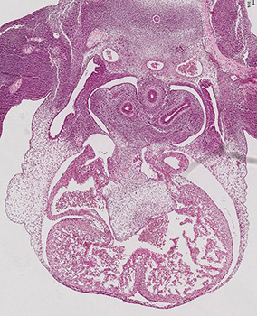 A histology section of a human embryo