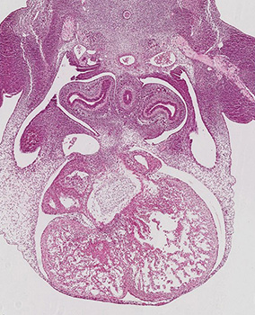A histology section of a human embryo