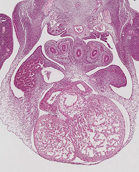 A histology section of a human embryo
