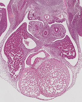 A histology section of a human embryo