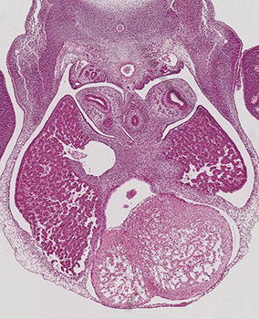 A histology section of a human embryo