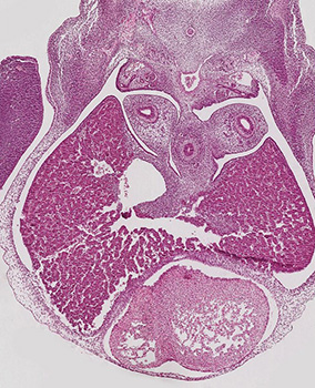 A histology section of a human embryo