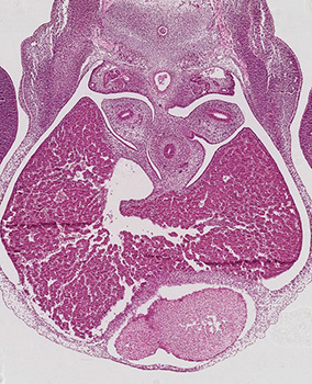 A histology section of a human embryo