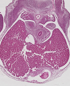 A histology section of a human embryo