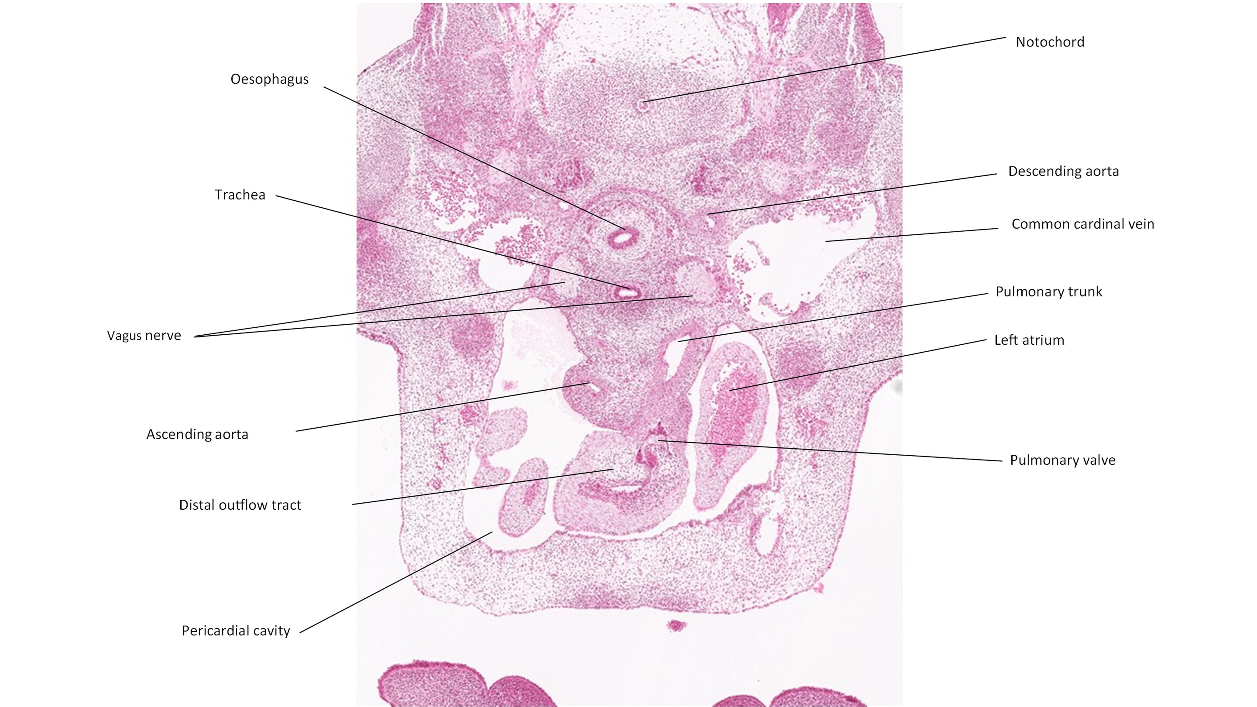 A histology section of a human embryo