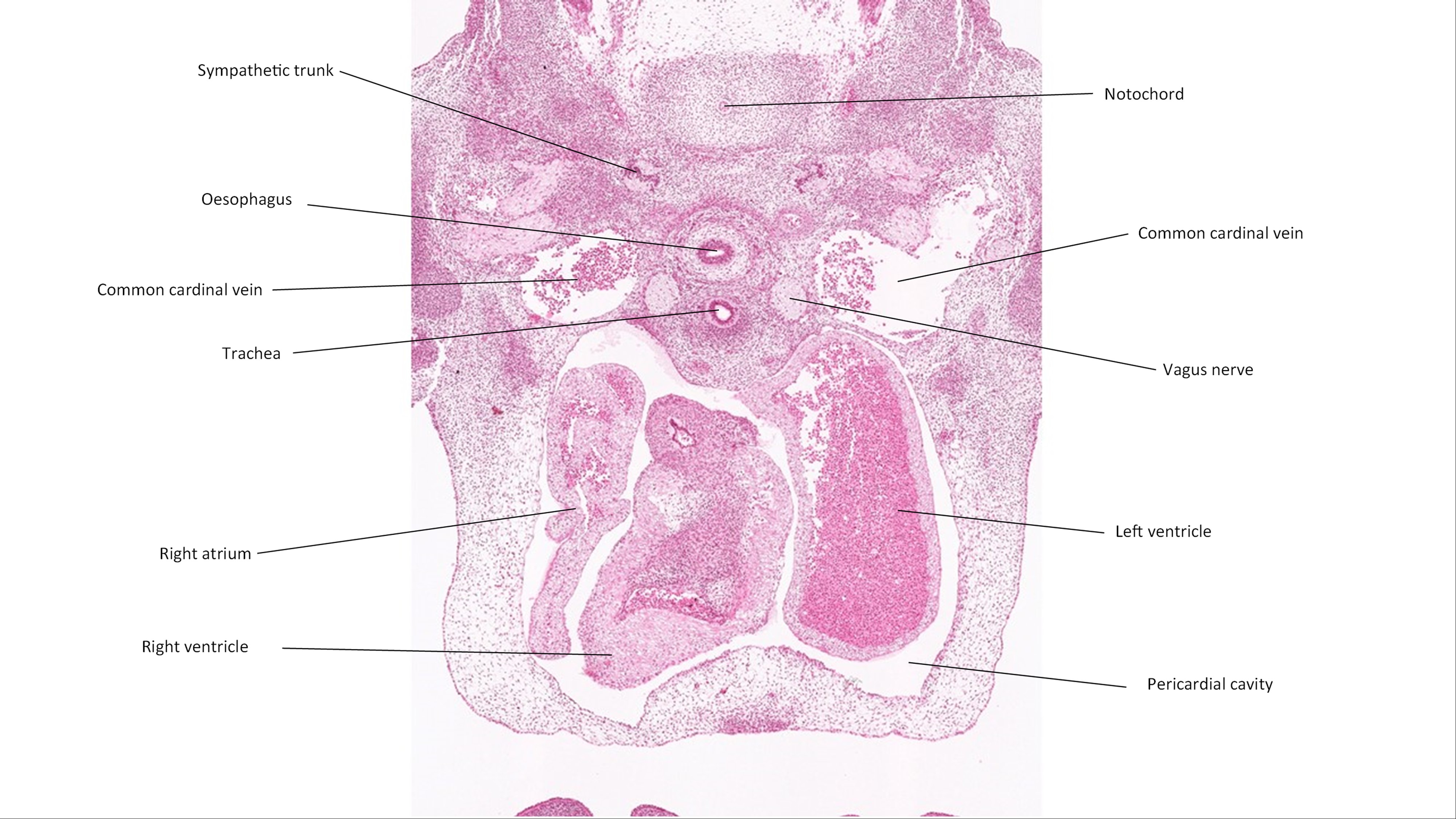 A histology section of a human embryo