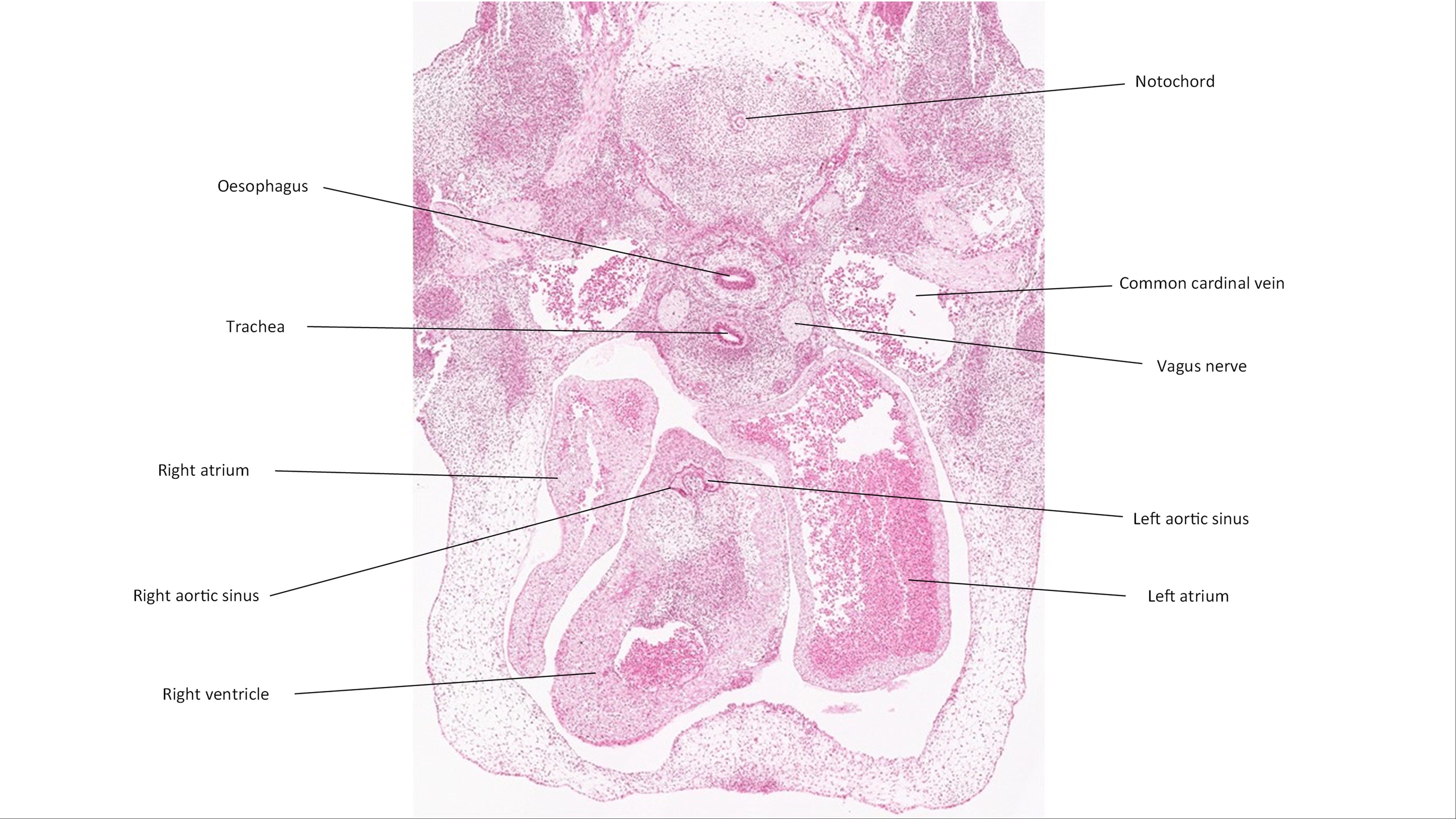 A histology section of a human embryo