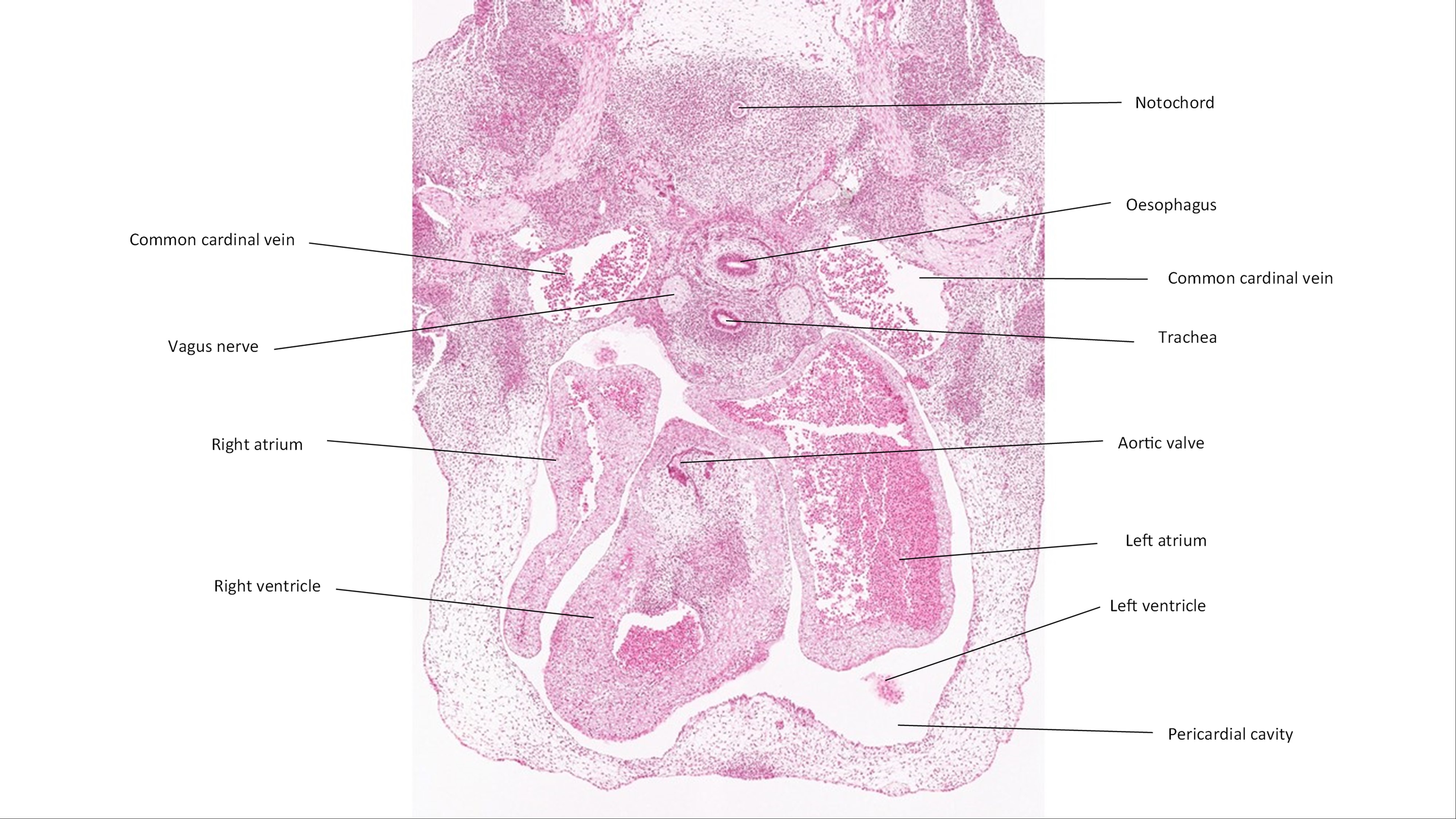 A histology section of a human embryo
