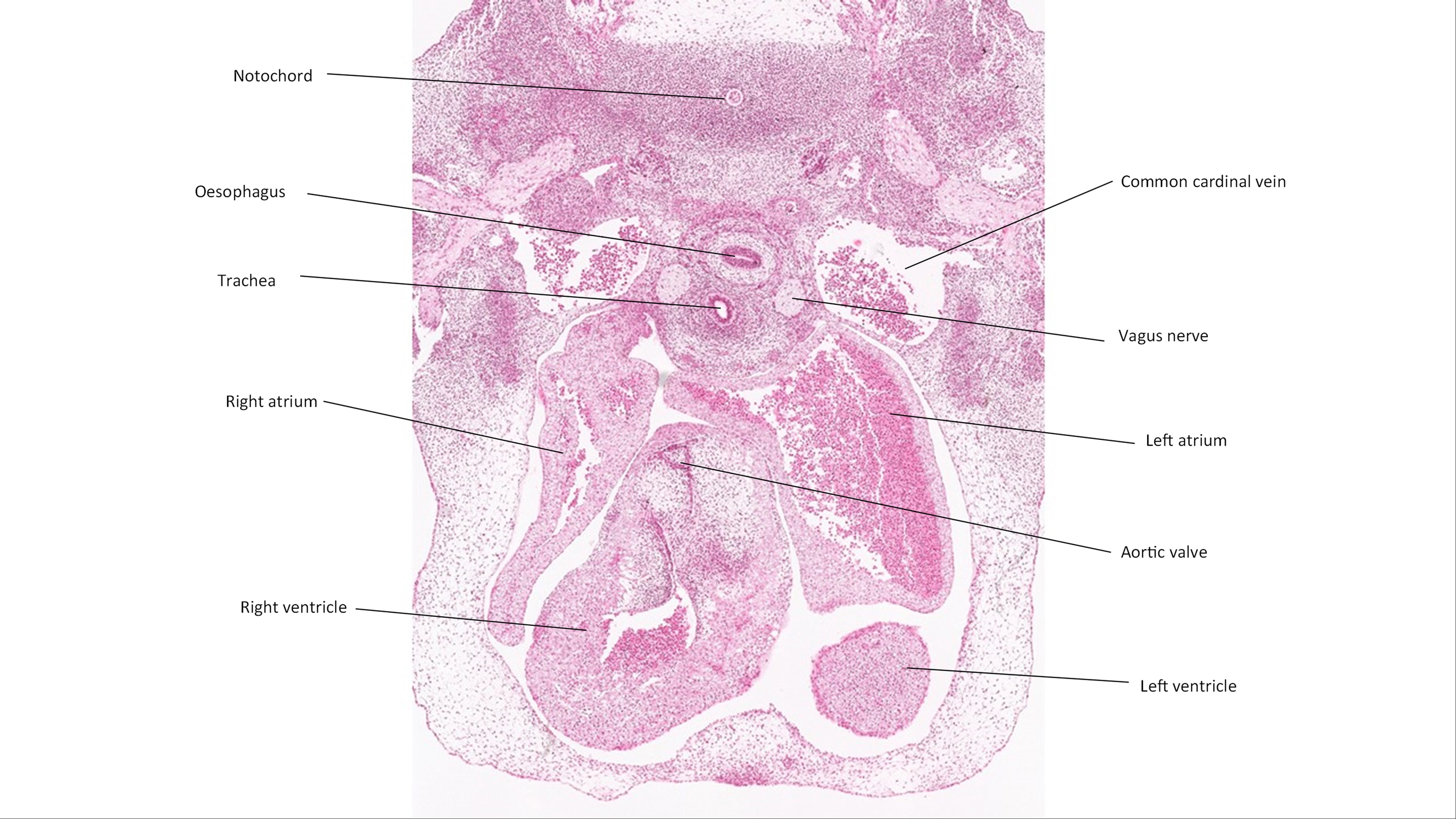 A histology section of a human embryo