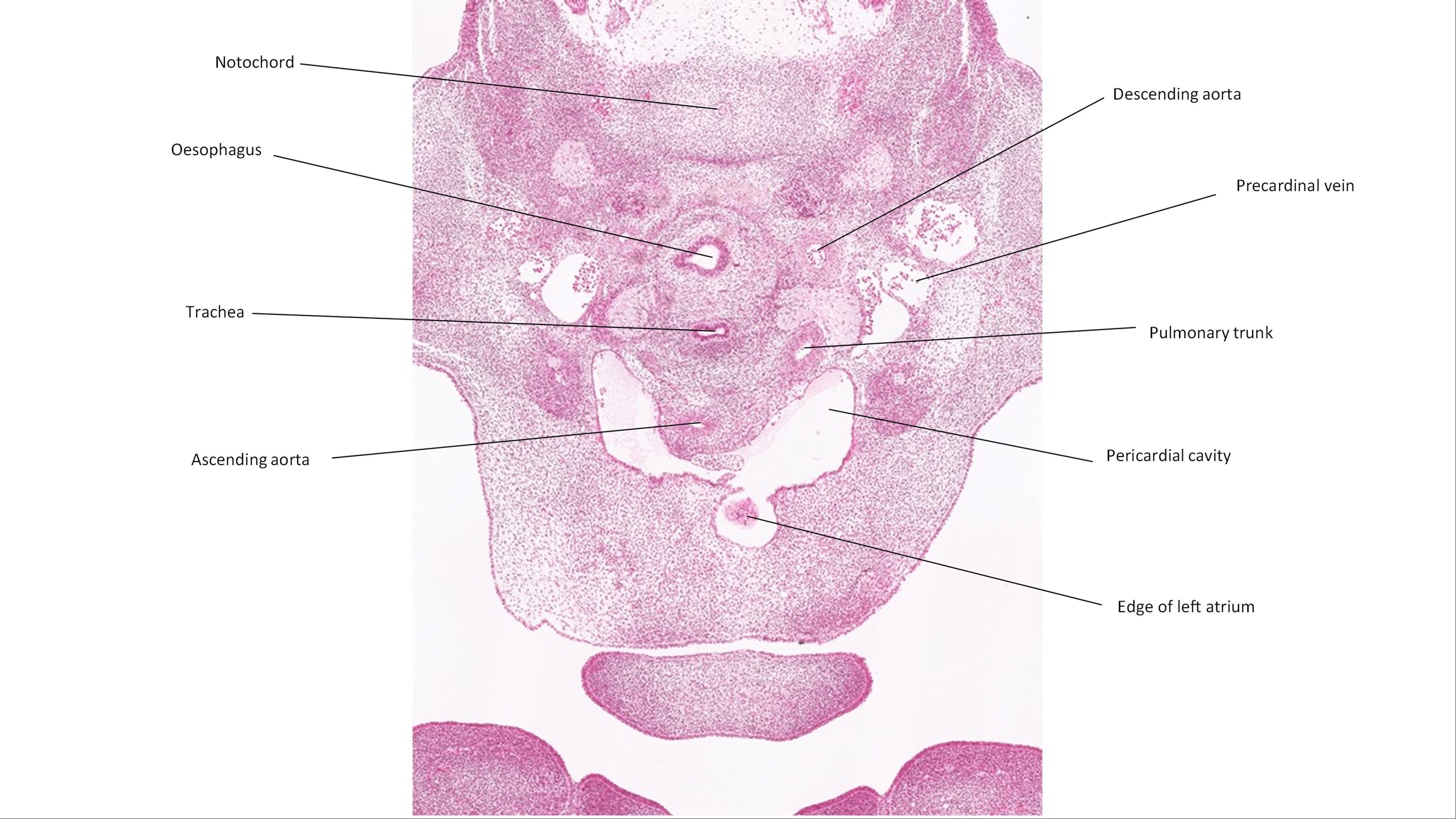 A histology section of a human embryo