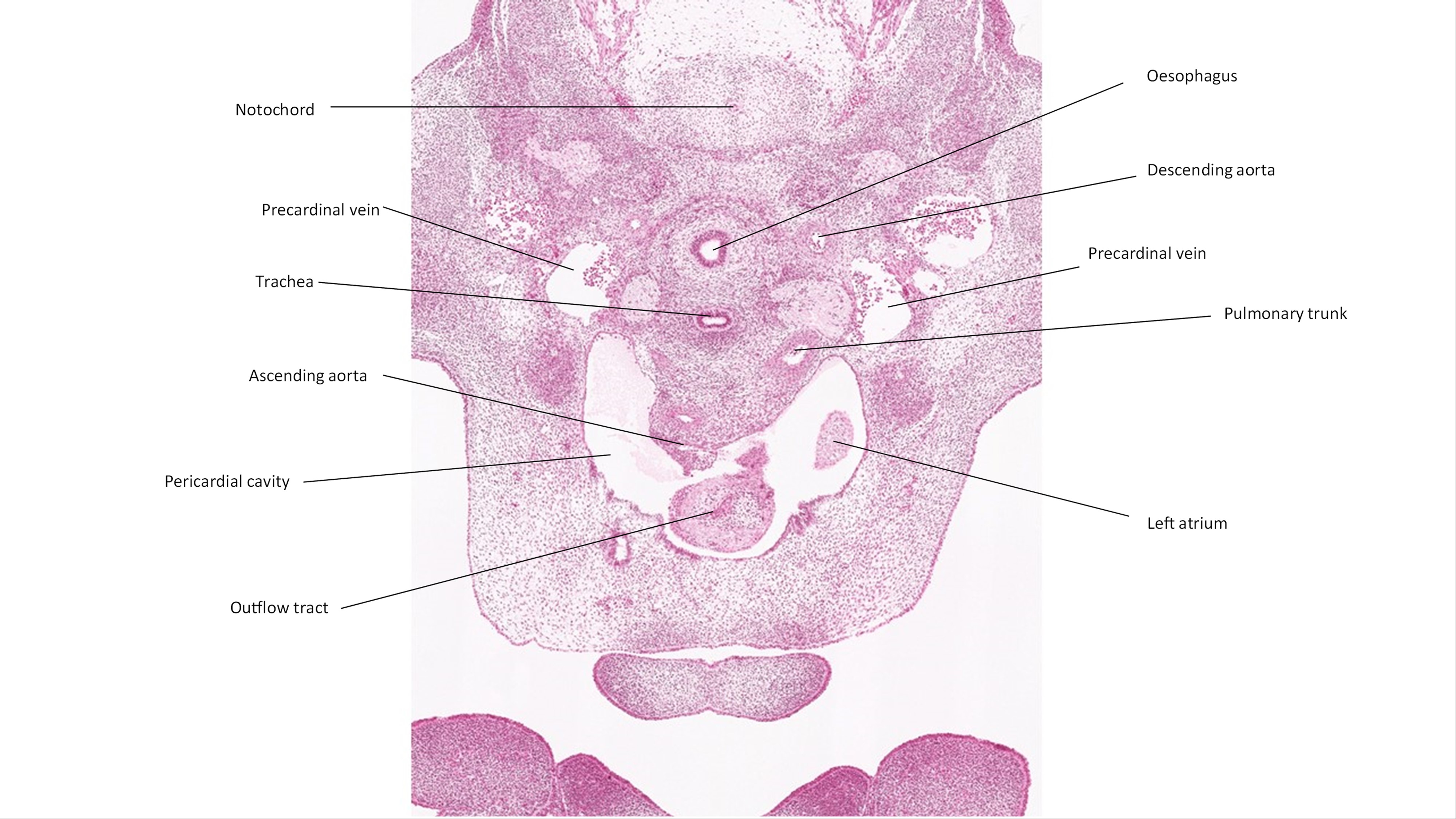 A histology section of a human embryo