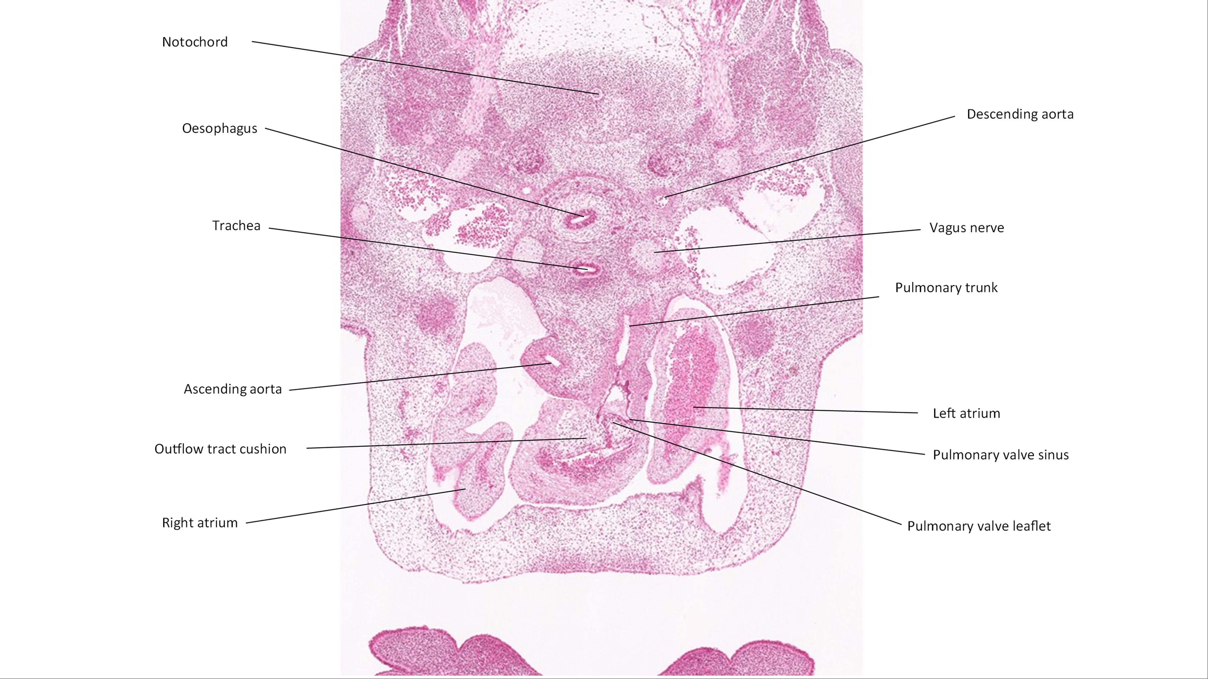 A histology section of a human embryo