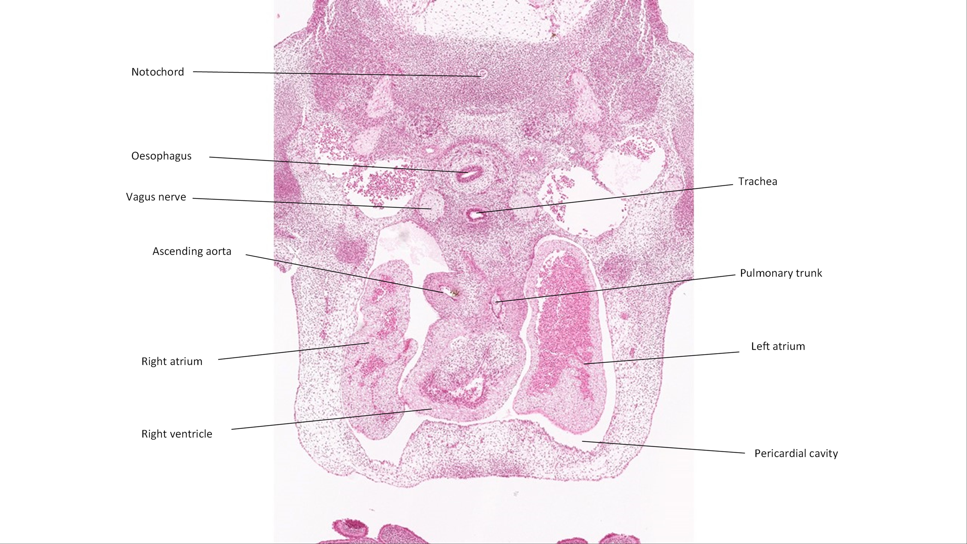 A histology section of a human embryo