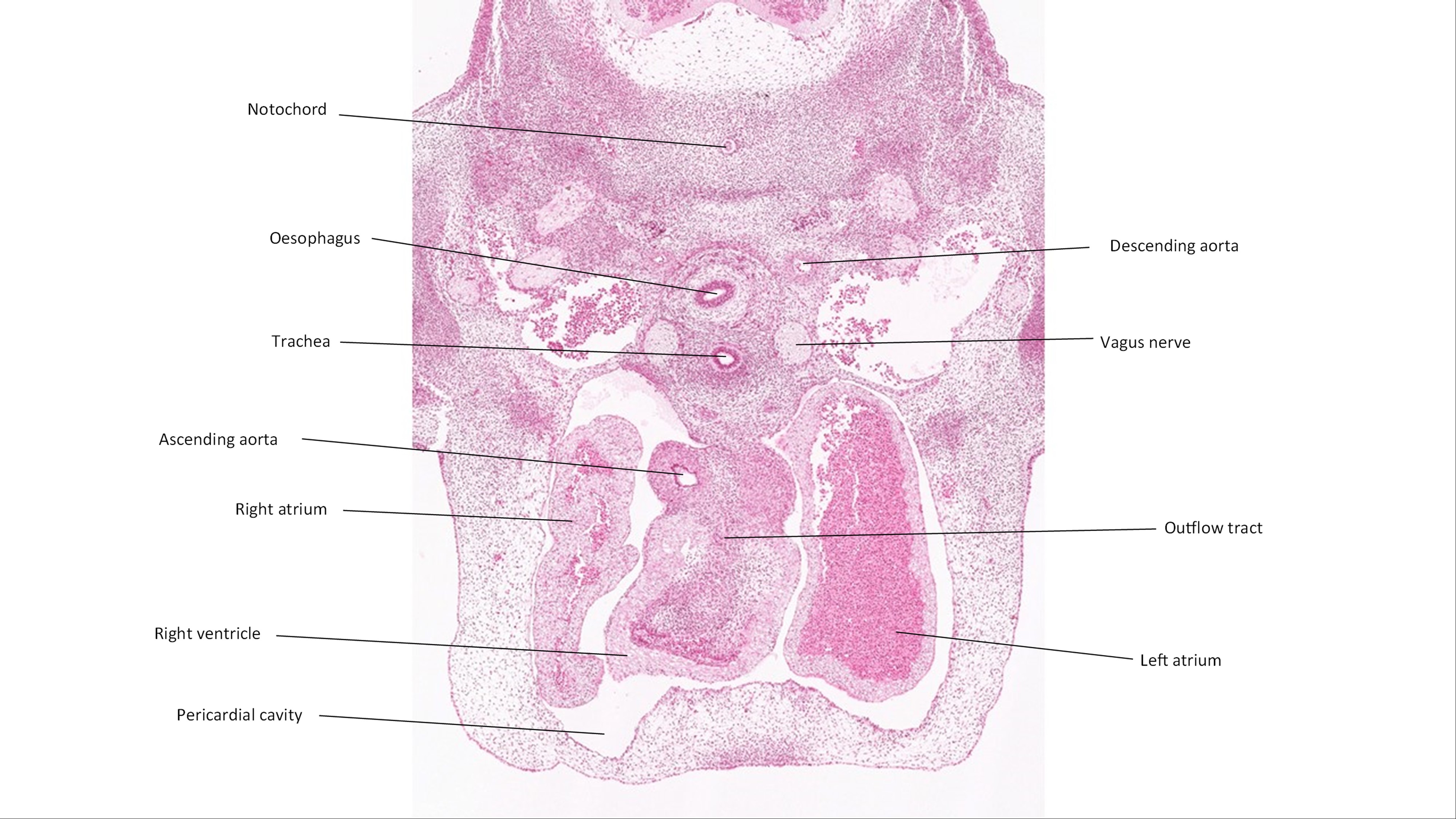 A histology section of a human embryo