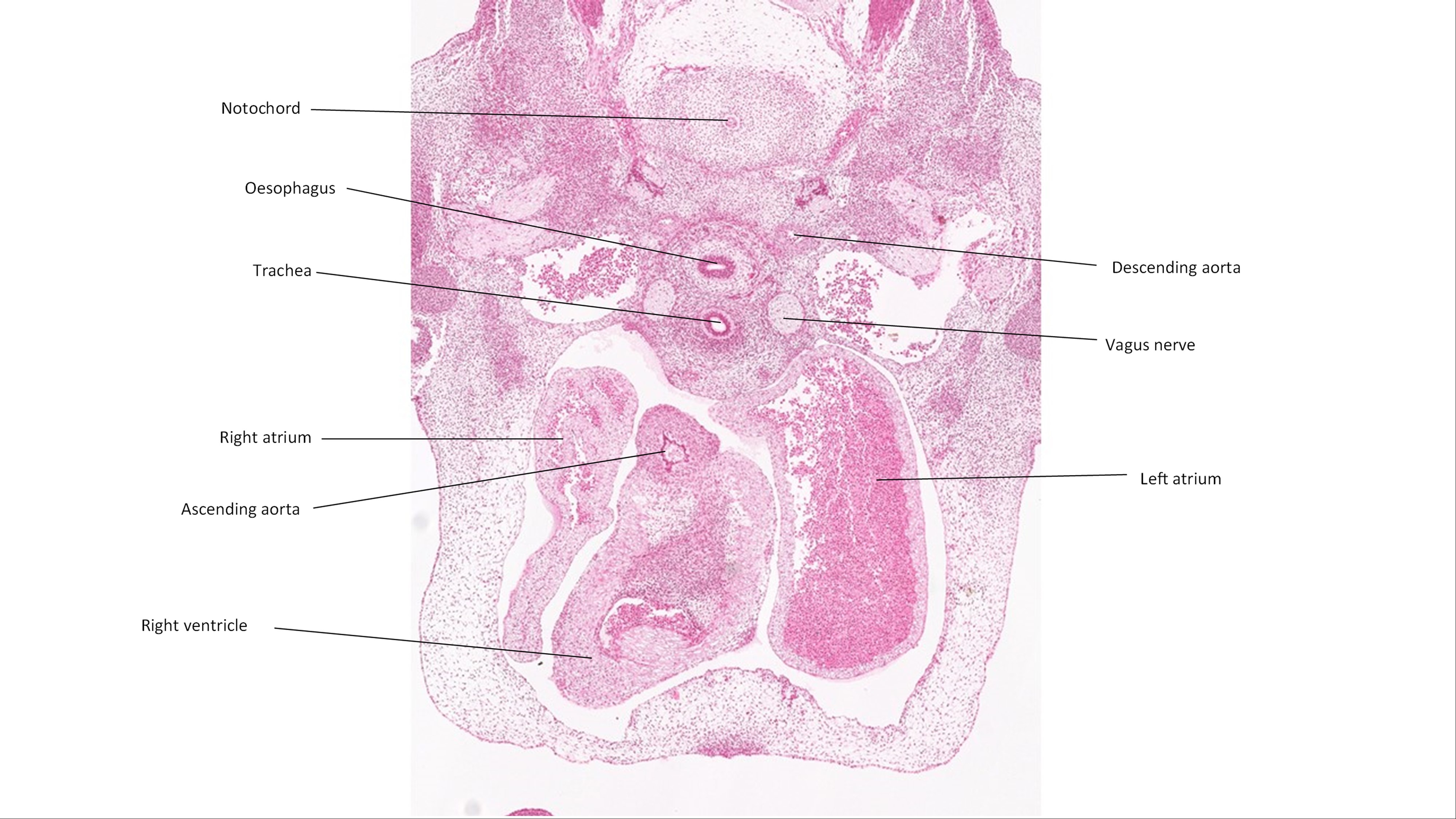 A histology section of a human embryo