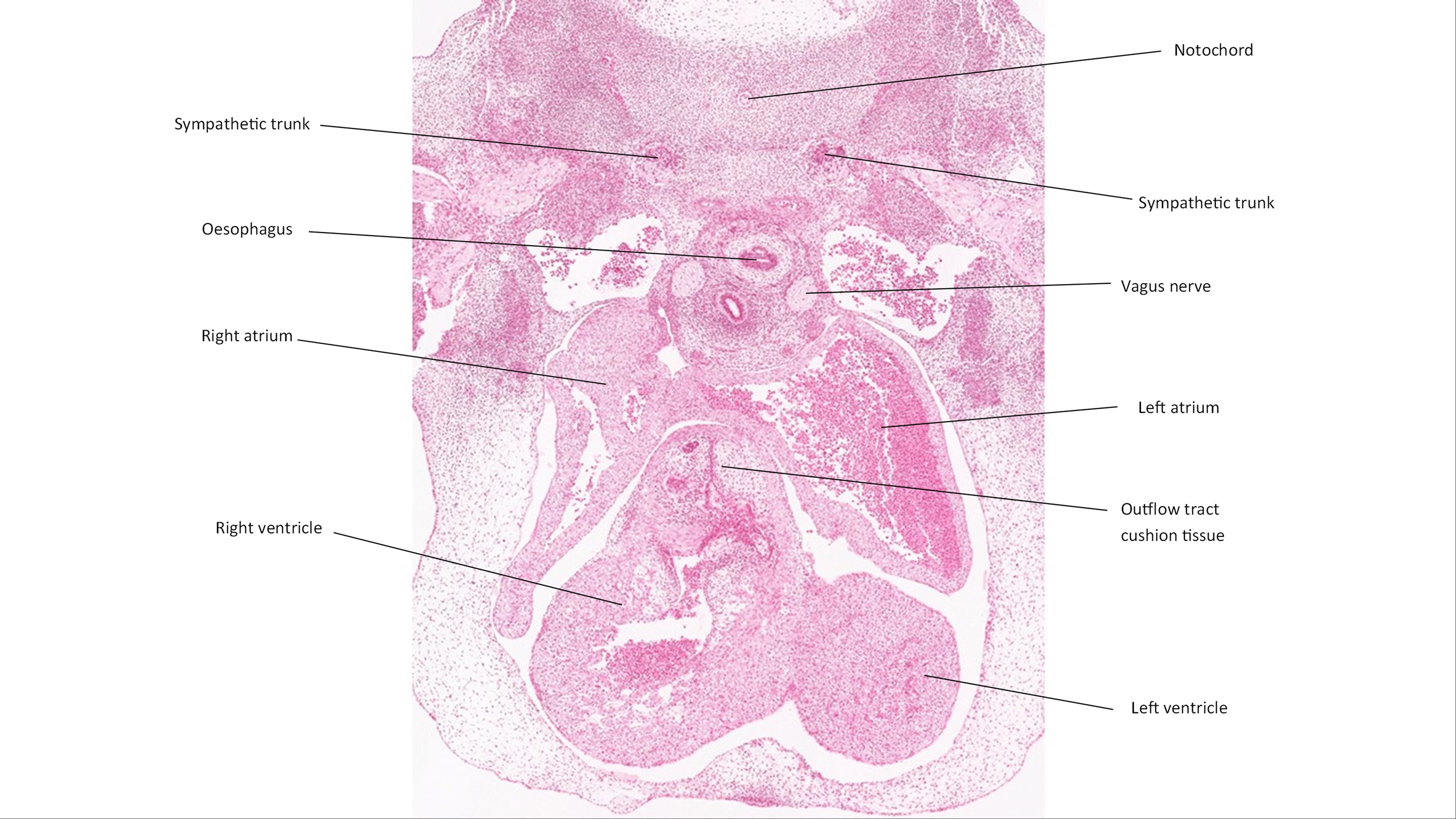 A histology section of a human embryo