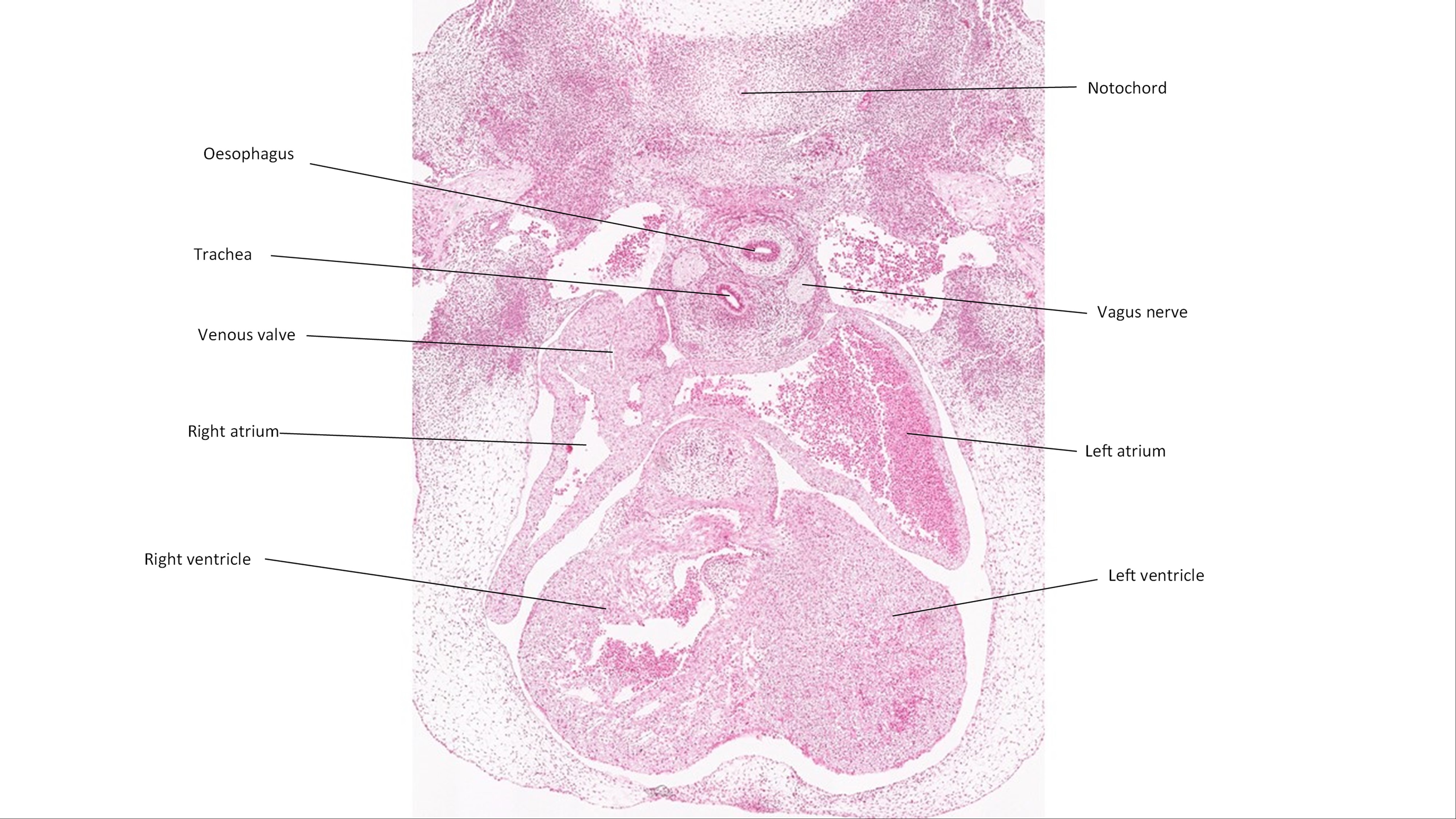A histology section of a human embryo