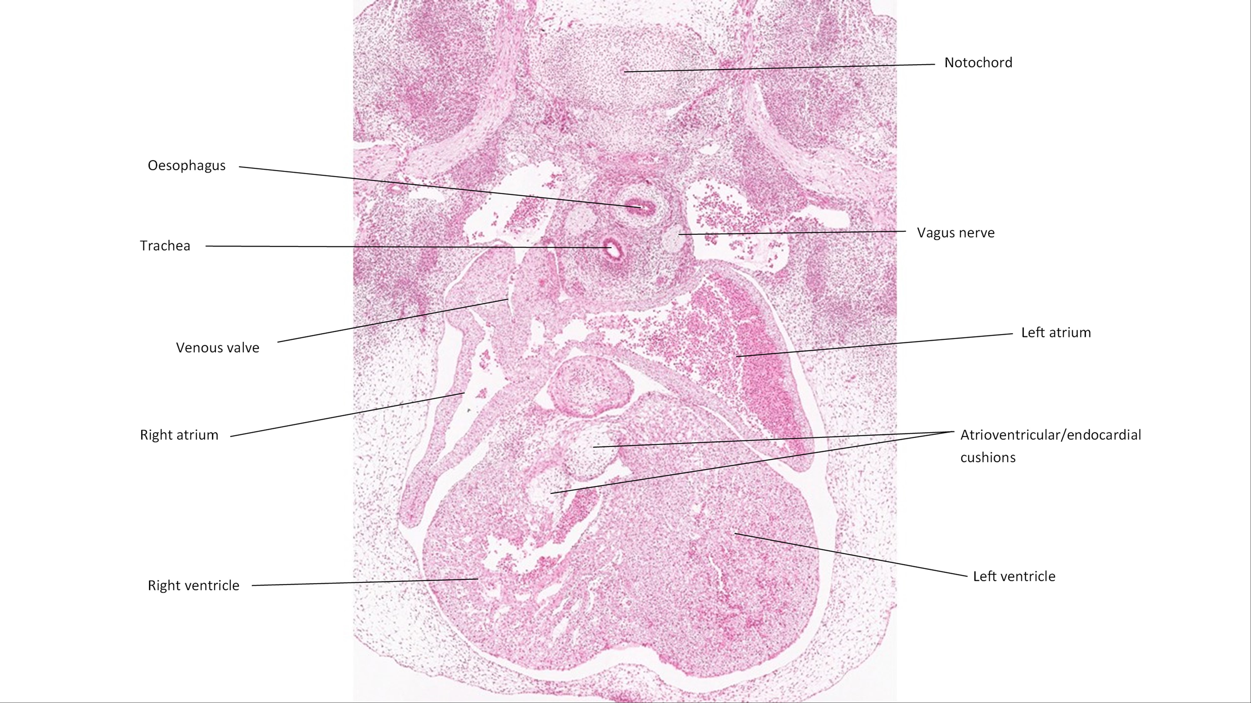 A histology section of a human embryo