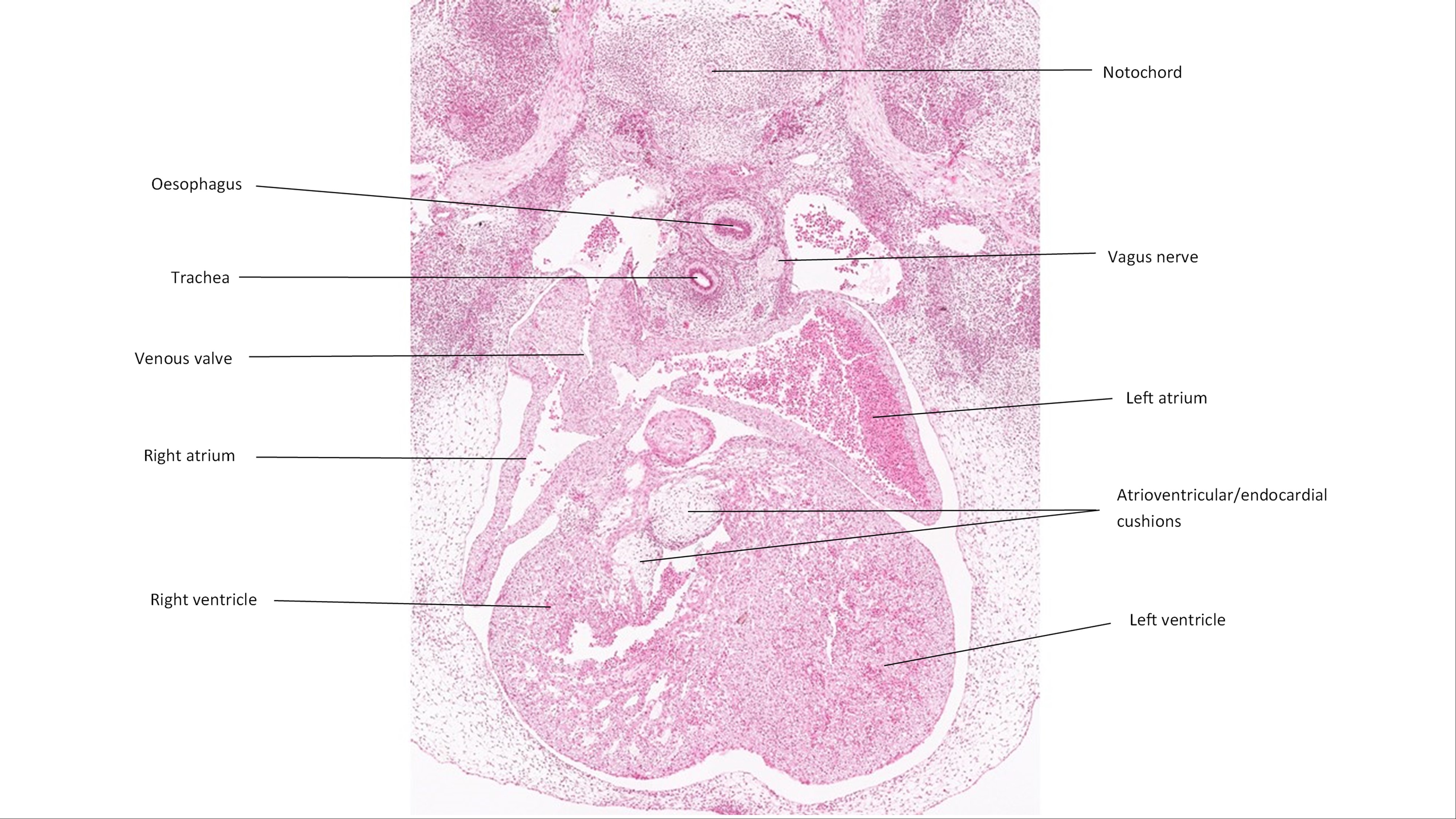 A histology section of a human embryo