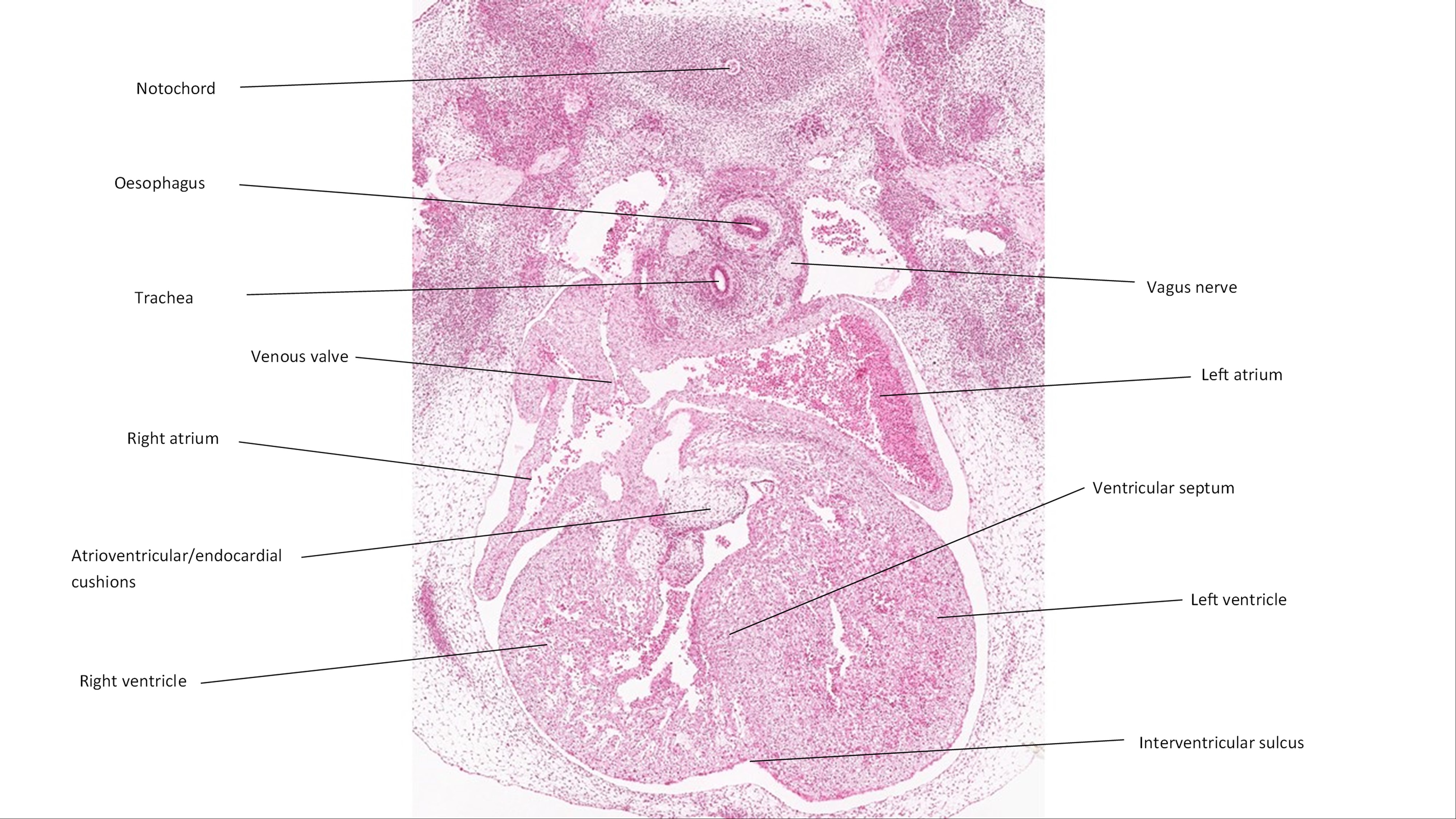 A histology section of a human embryo