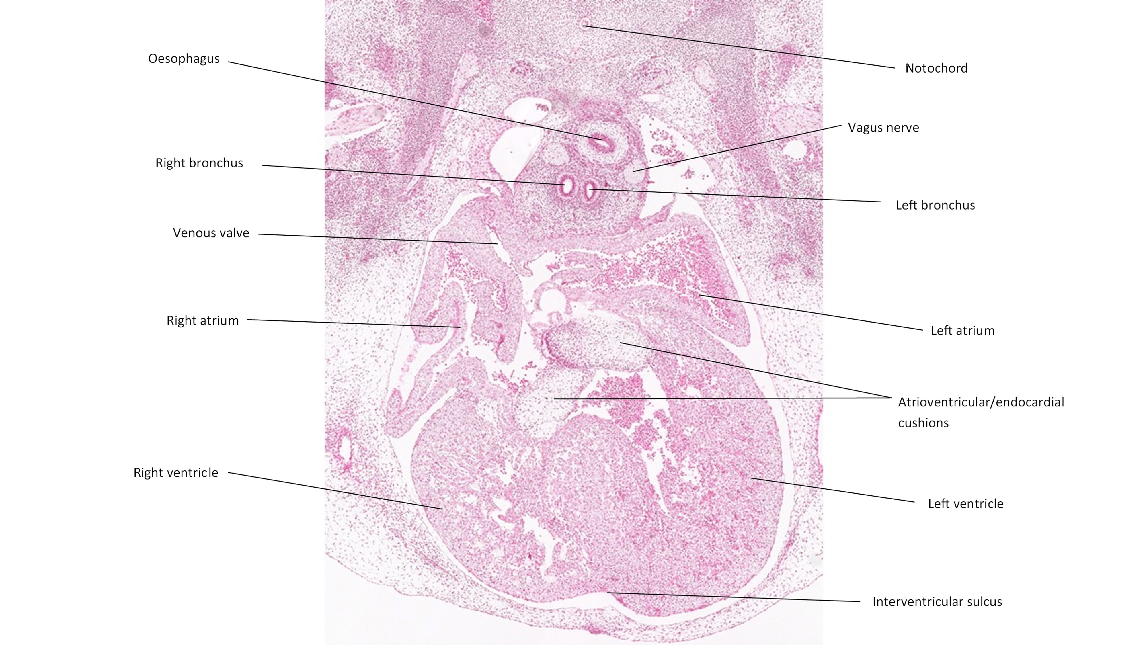A histology section of a human embryo