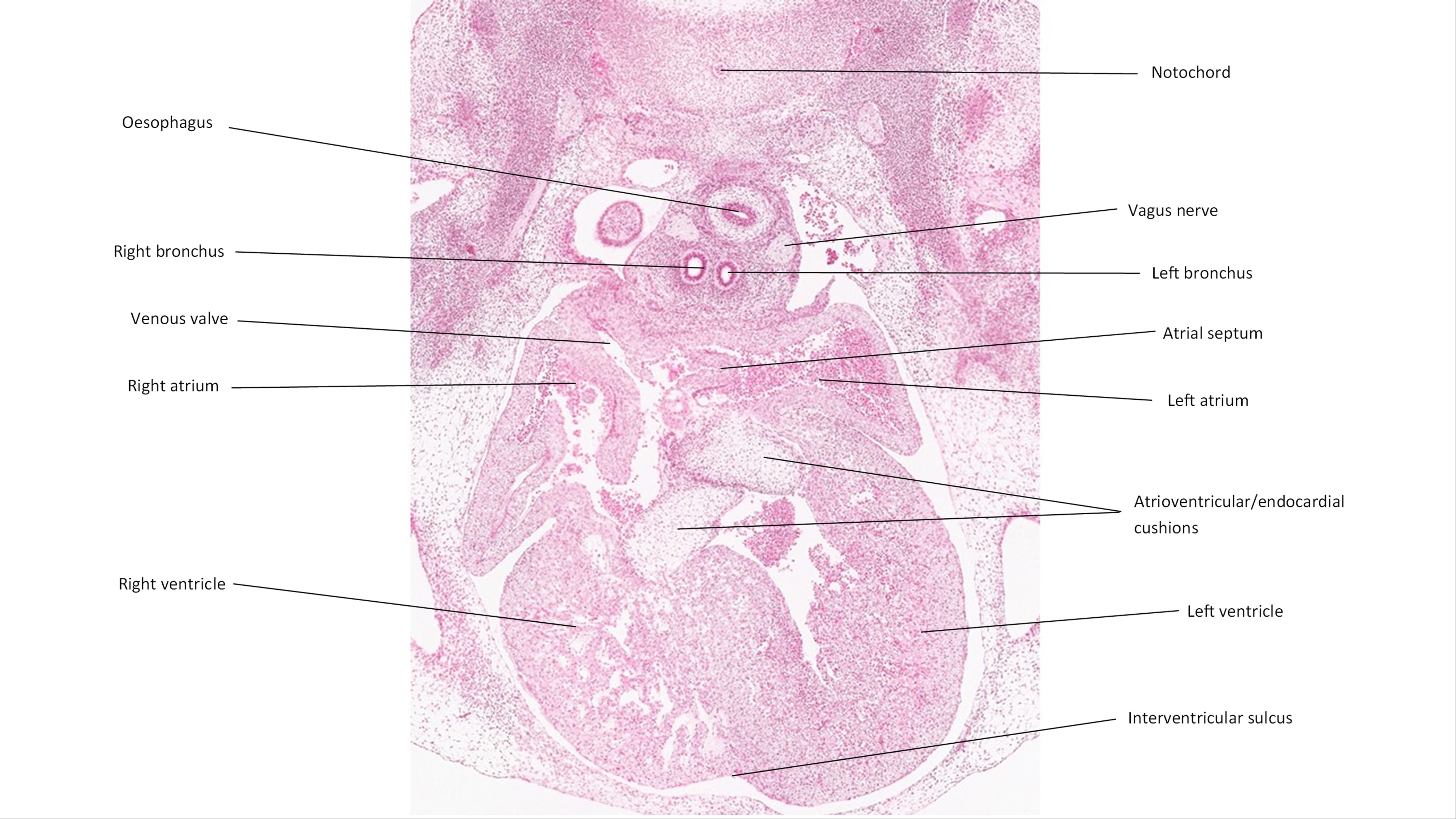 A histology section of a human embryo