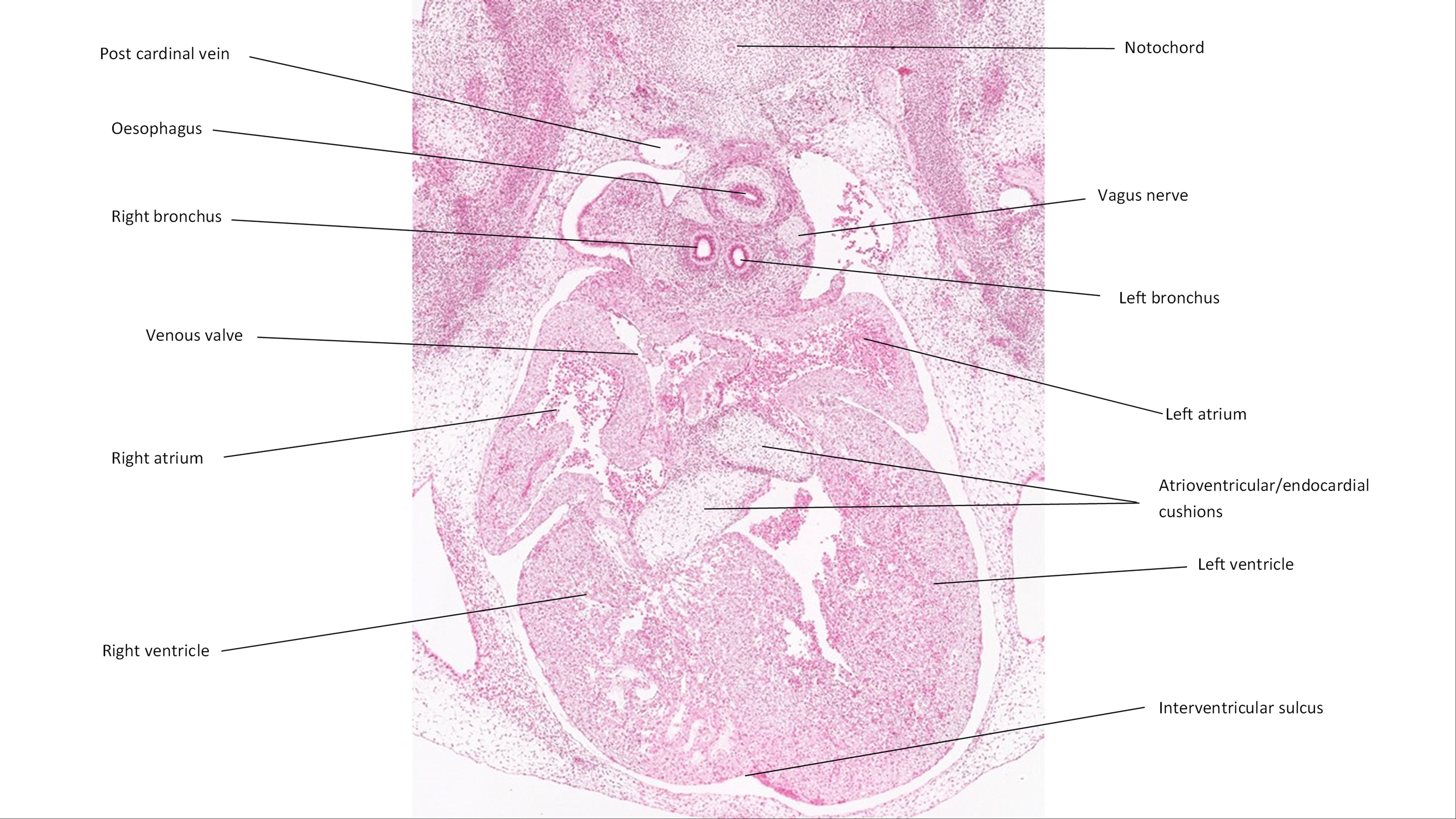 A histology section of a human embryo
