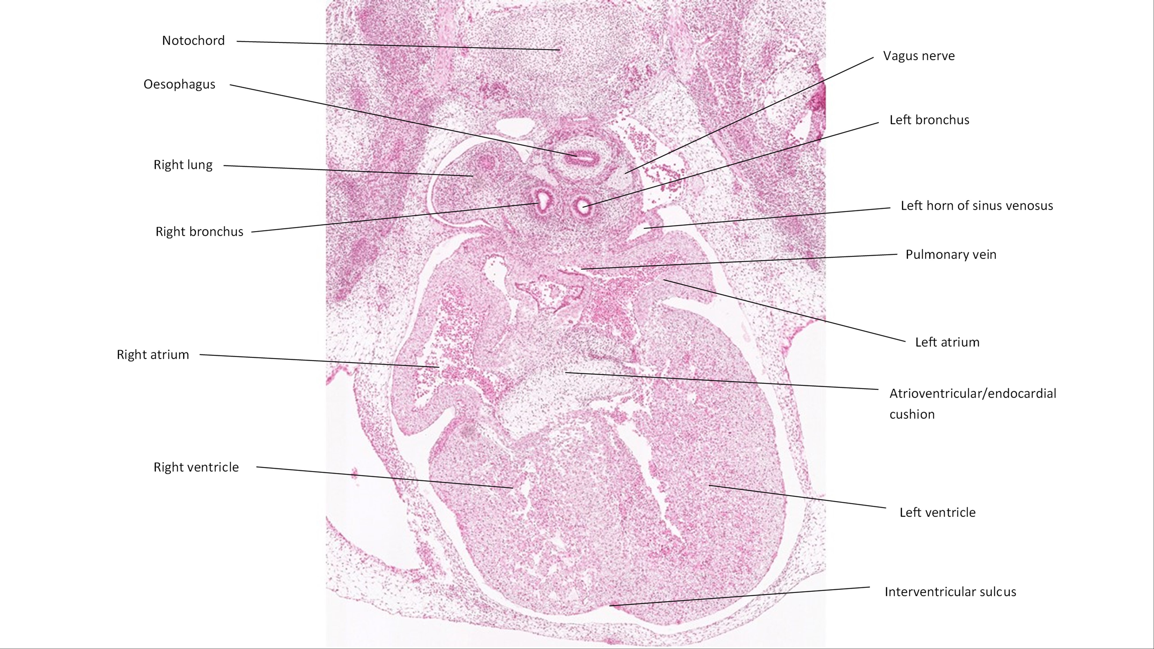A histology section of a human embryo