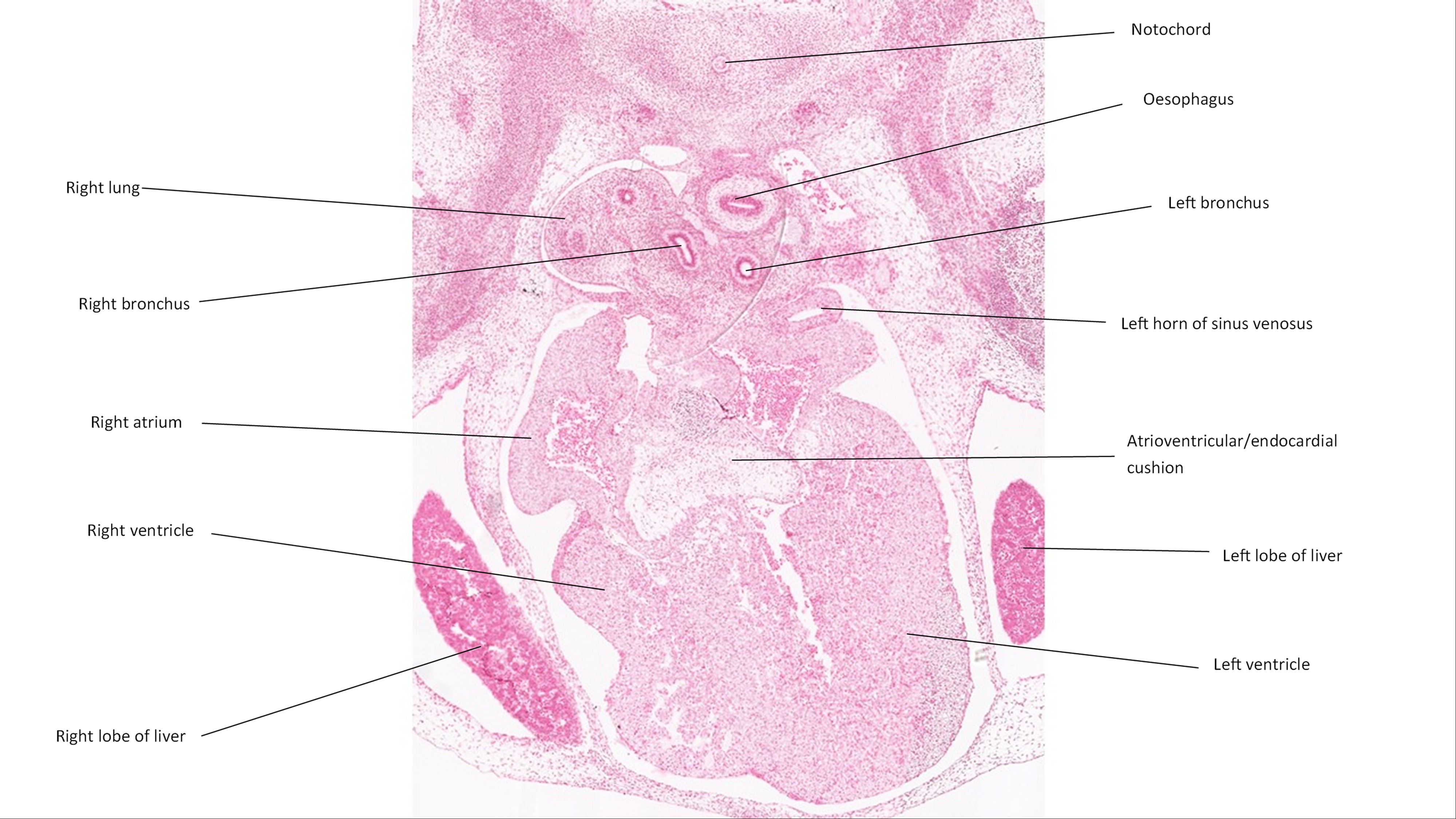 A histology section of a human embryo