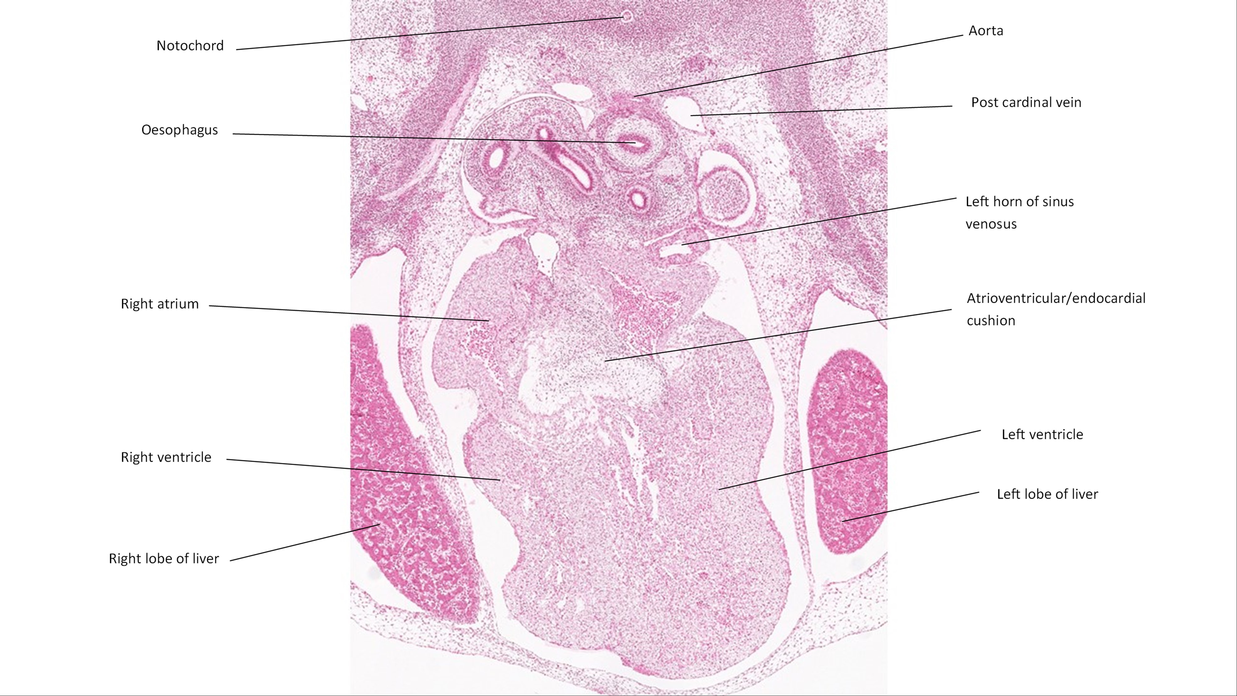 A histology section of a human embryo