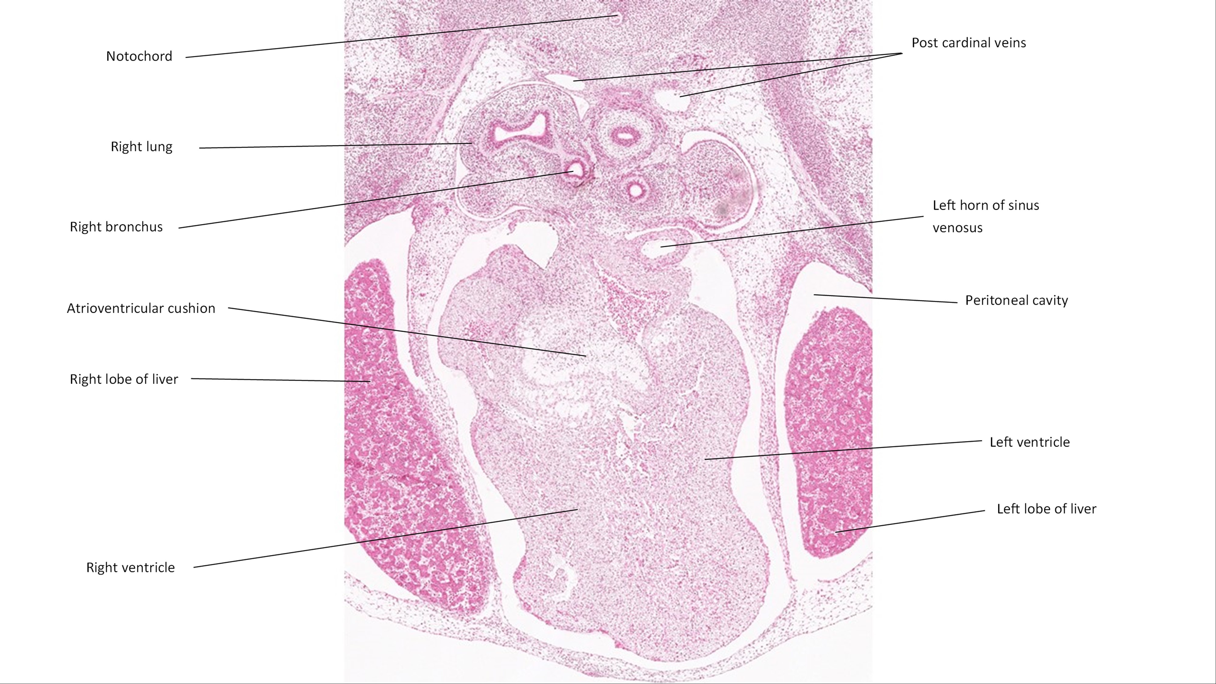 A histology section of a human embryo
