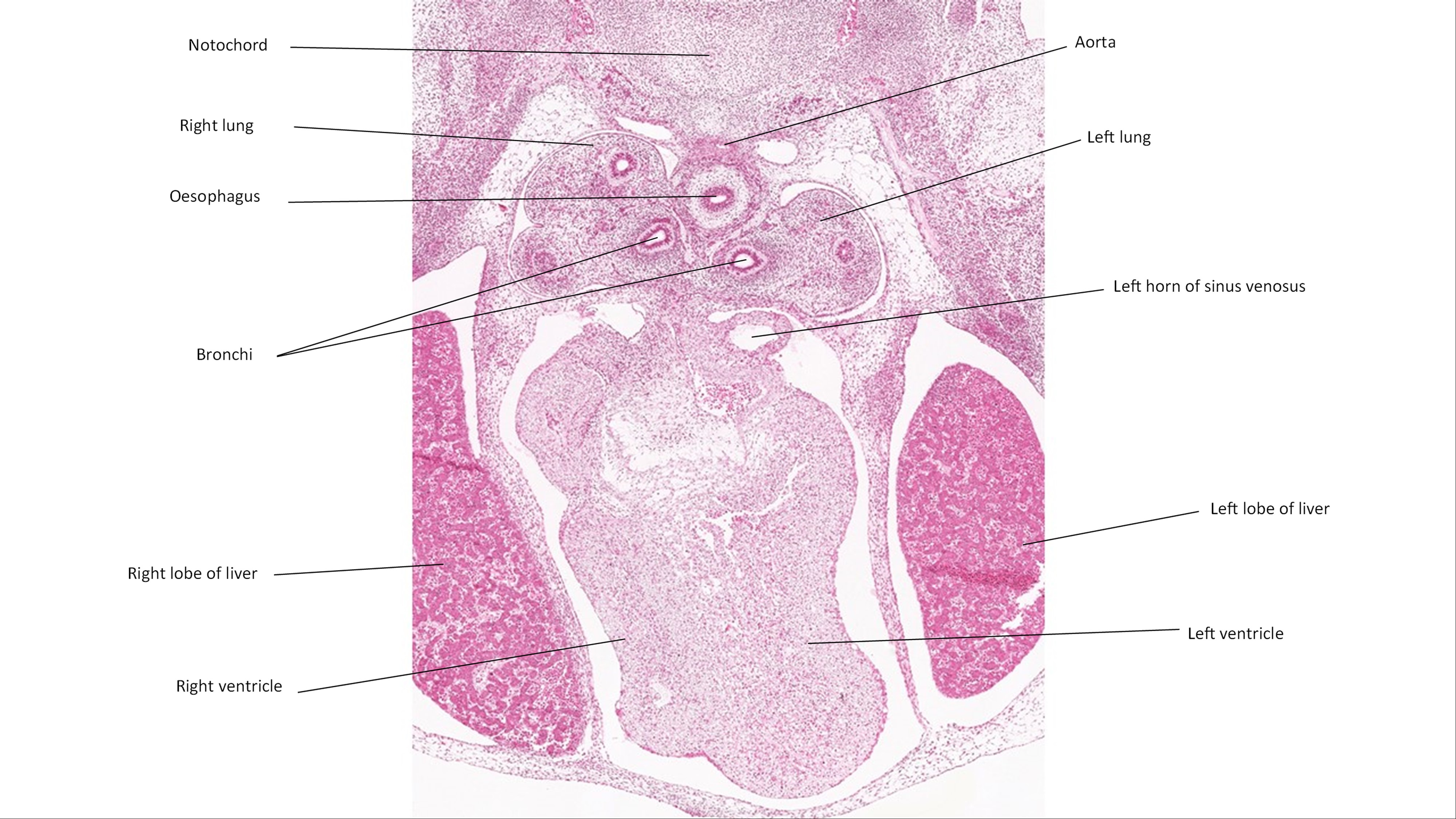 A histology section of a human embryo