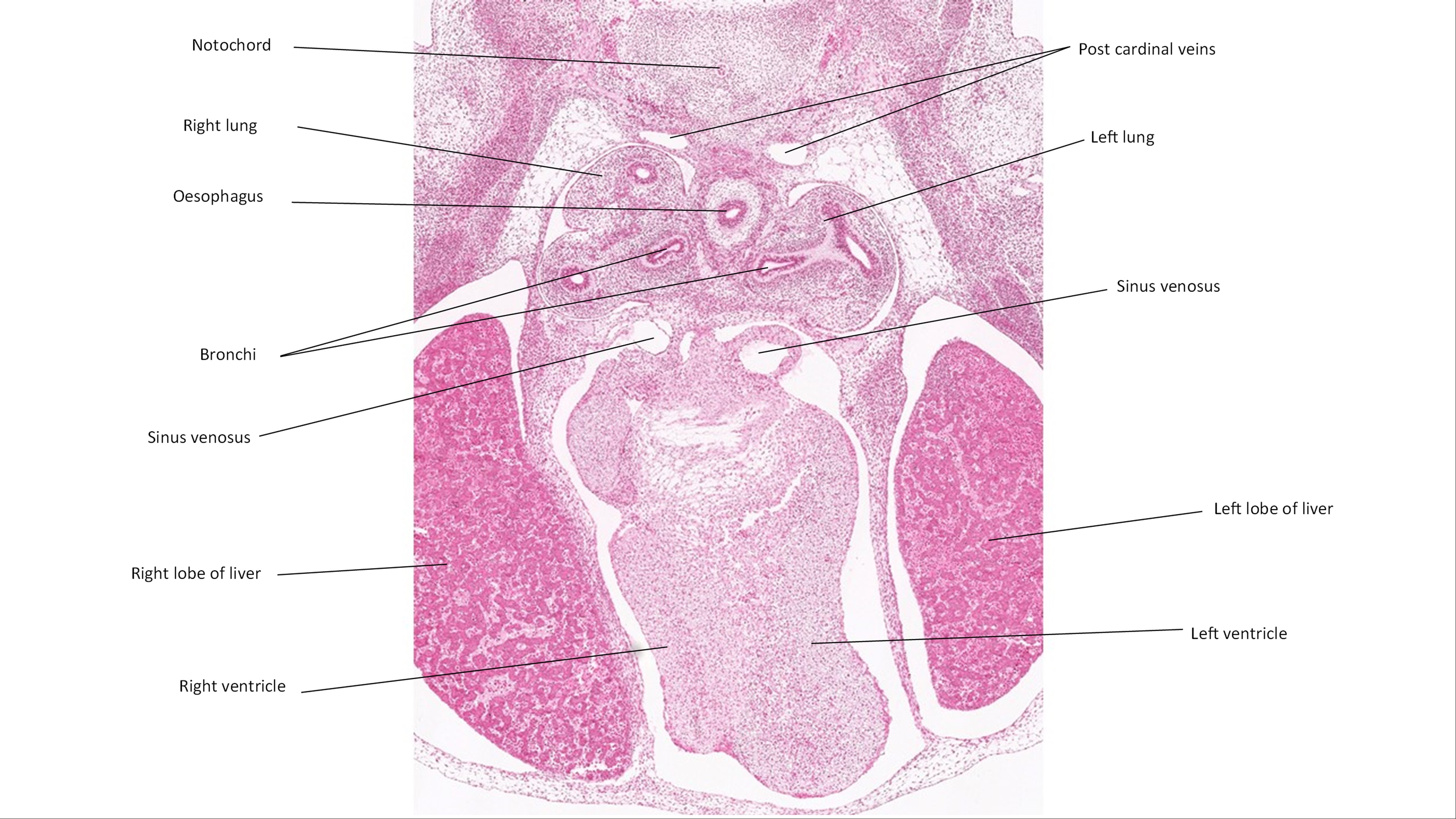A histology section of a human embryo