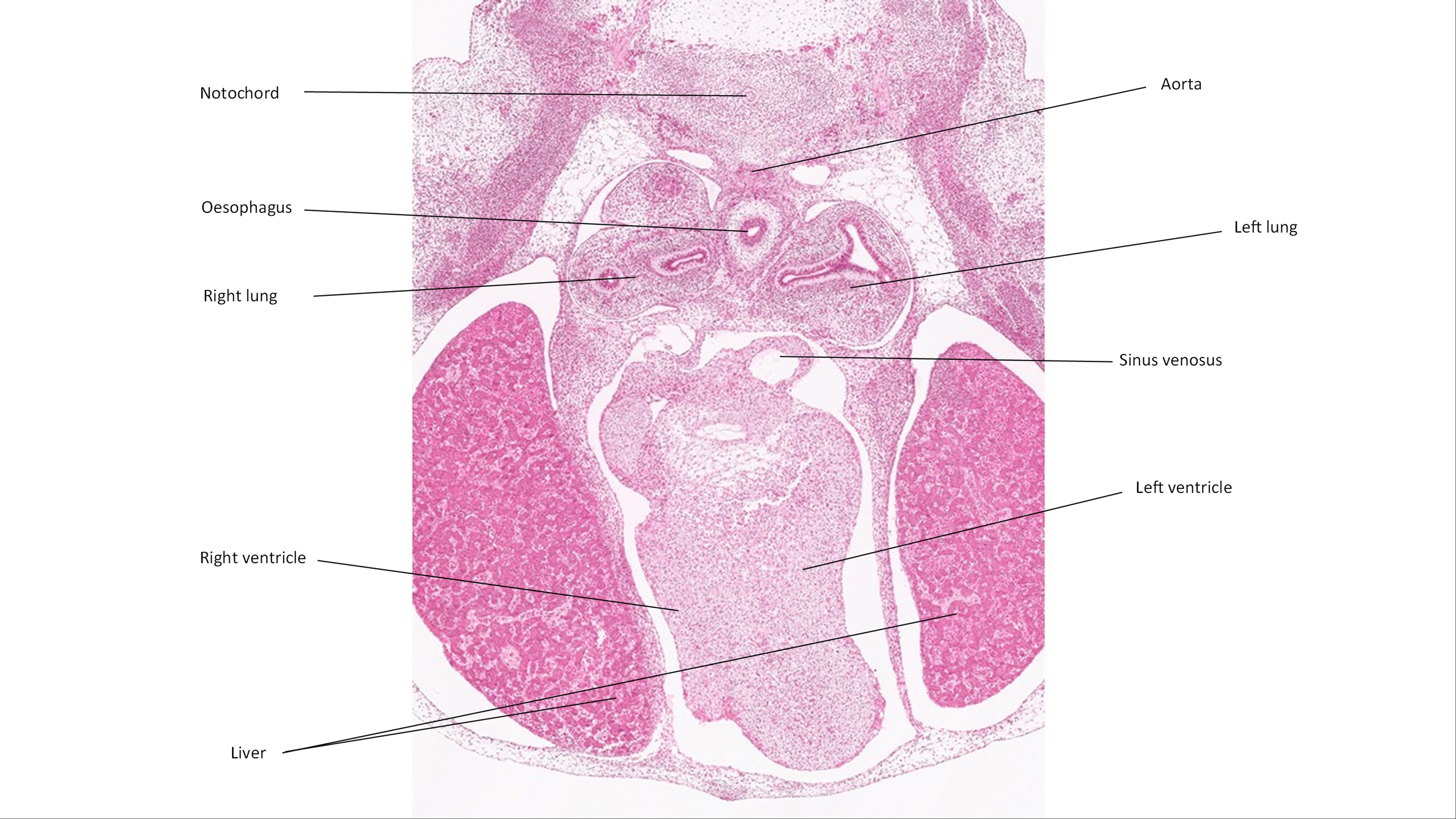 A histology section of a human embryo