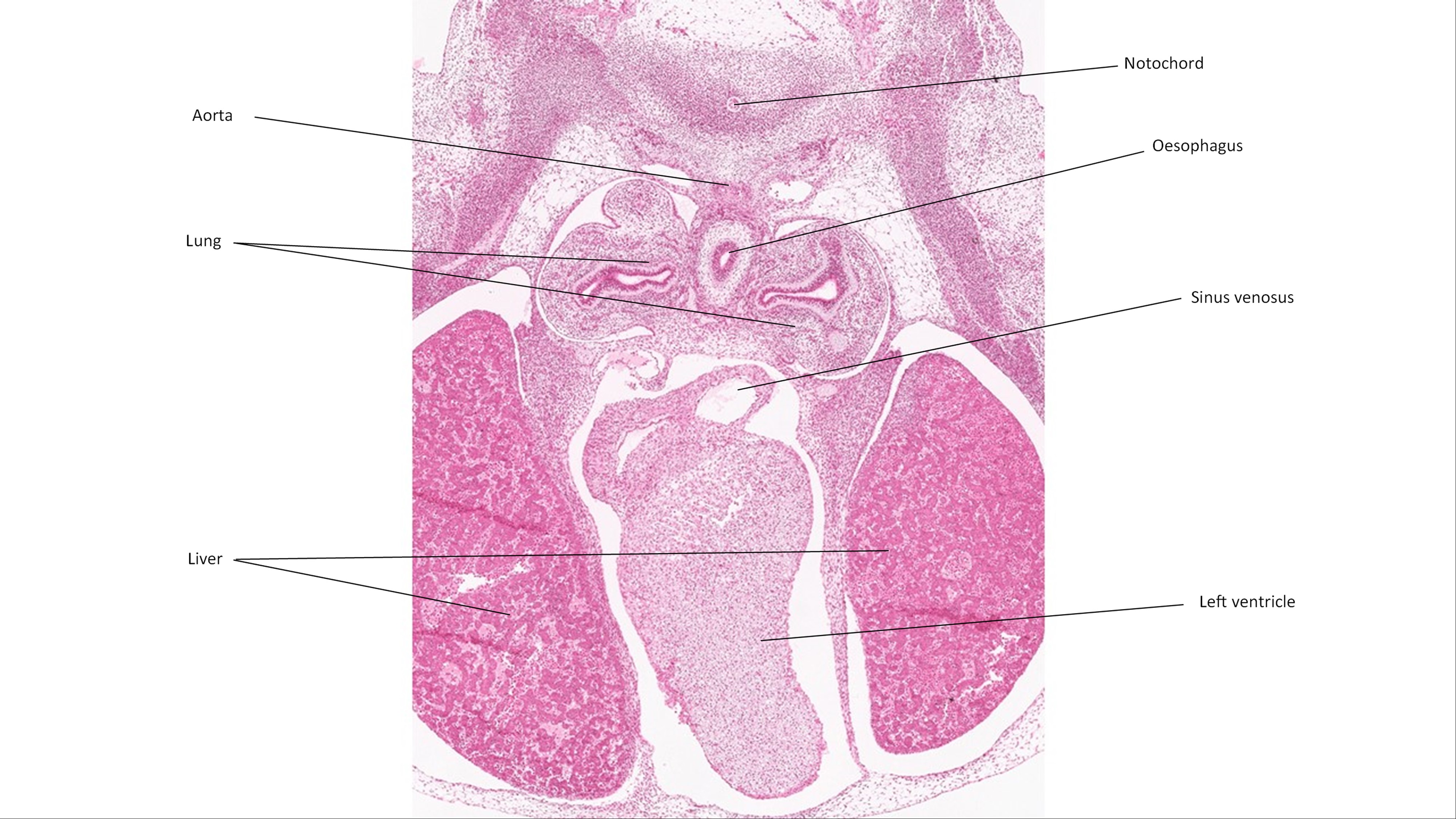 A histology section of a human embryo