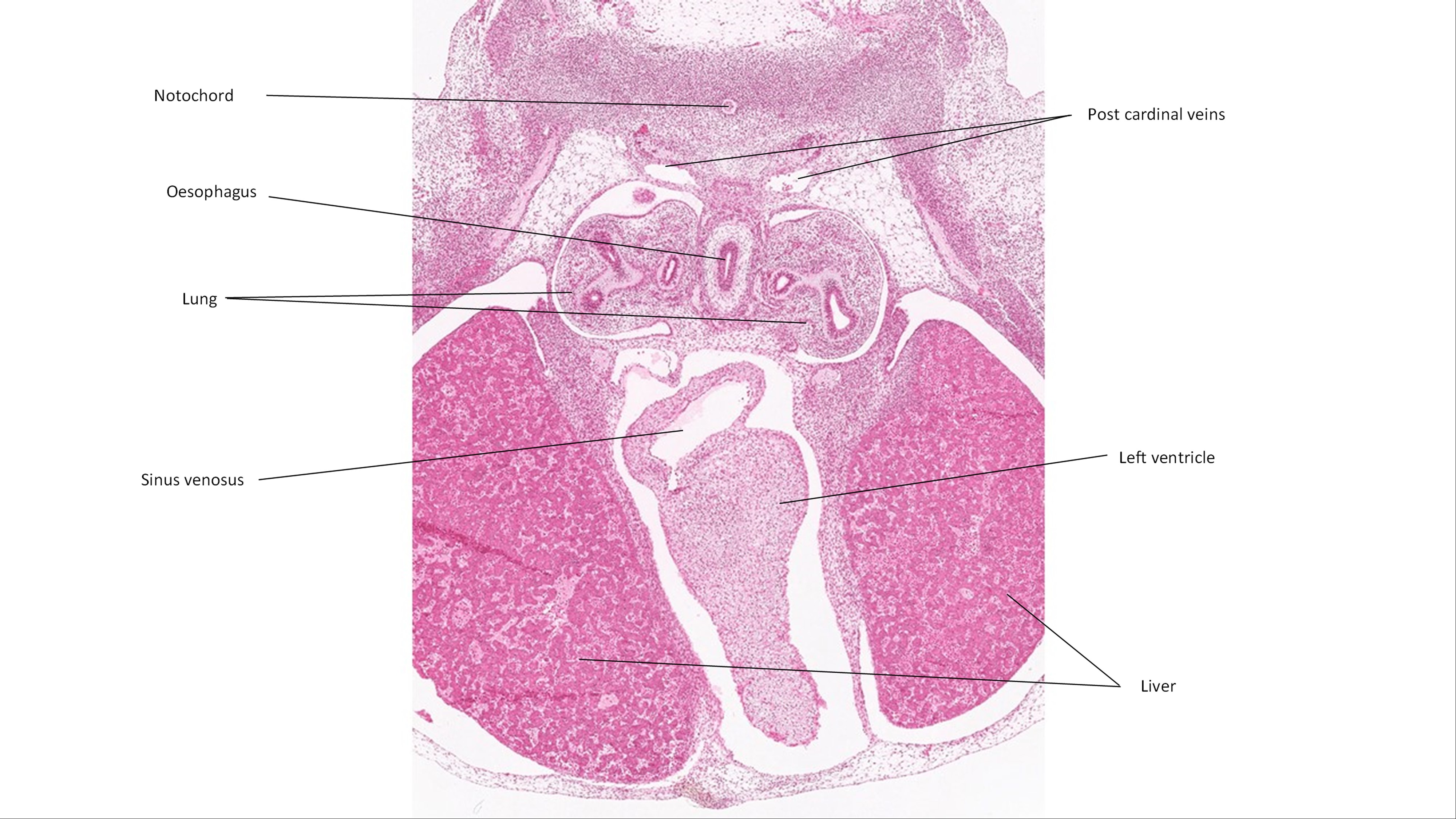 A histology section of a human embryo