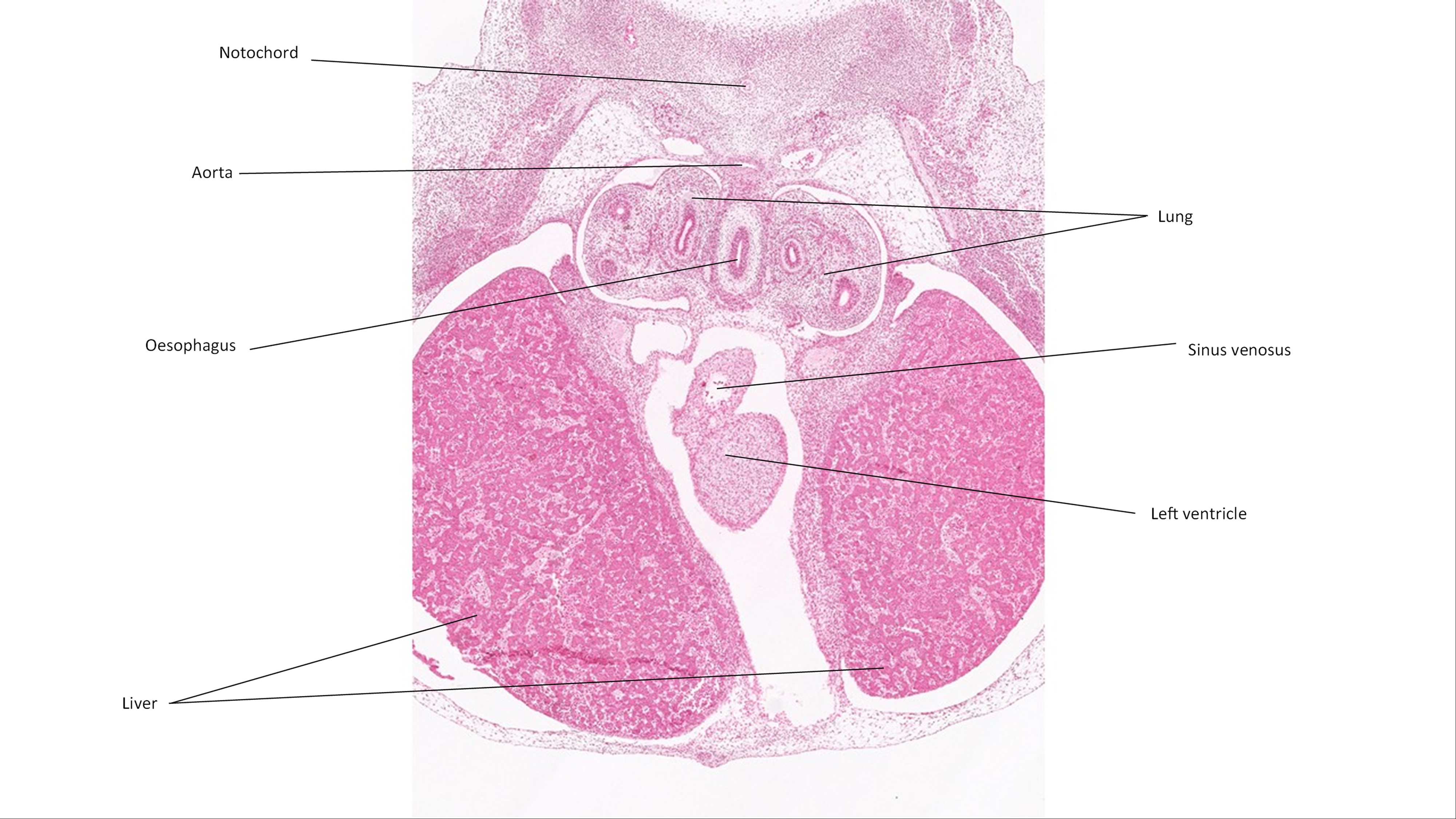 A histology section of a human embryo