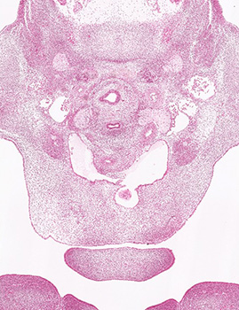 A histology section of a human embryo