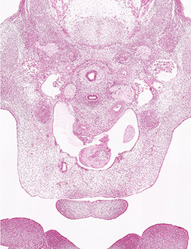 A histology section of a human embryo