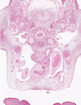 A histology section of a human embryo