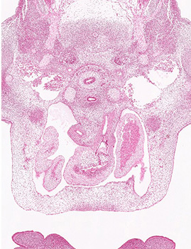 A histology section of a human embryo