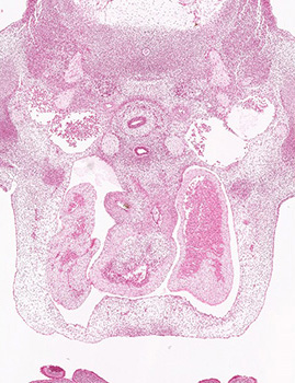 A histology section of a human embryo