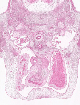 A histology section of a human embryo