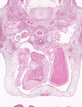 A histology section of a human embryo
