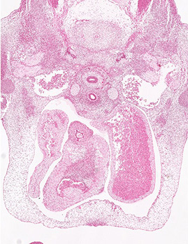 A histology section of a human embryo