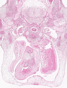 A histology section of a human embryo